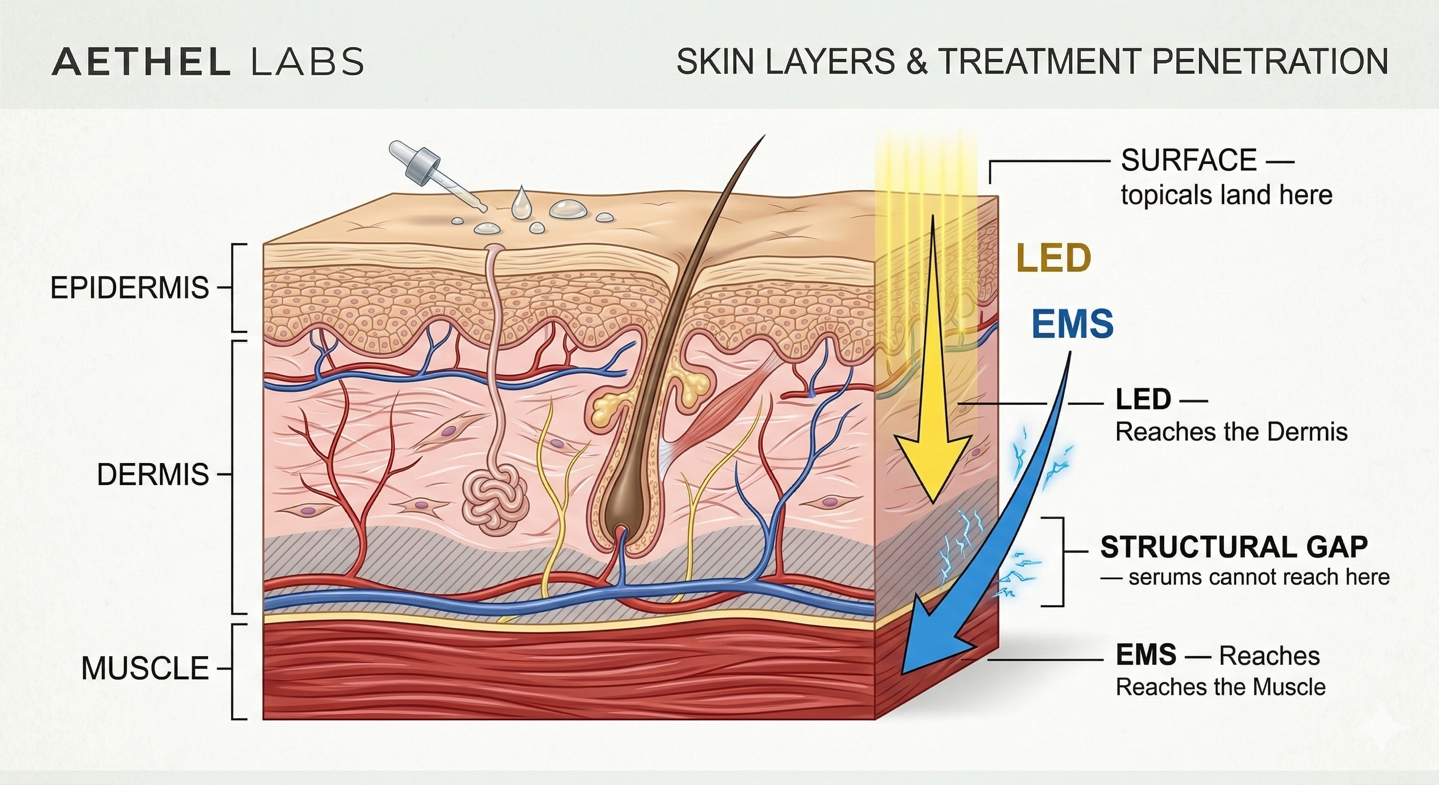 AETHEL LABS™ Dual Layer Lift System